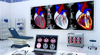 AI model improves speed and accuracy of heart MRI analysis
