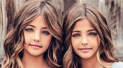 These Twins were named &quot;The Most Beautiful Twins In The World&quot;